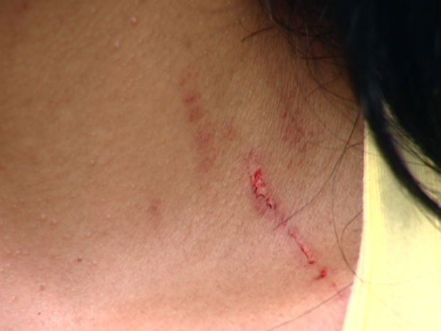 Briga entre mulheres termina com arranhões em Pinhalzinho